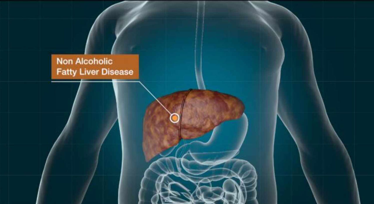 fatty liver services related treatment and service by Dr. Gajanan Rodge, best gastroenterologists in Mumbai