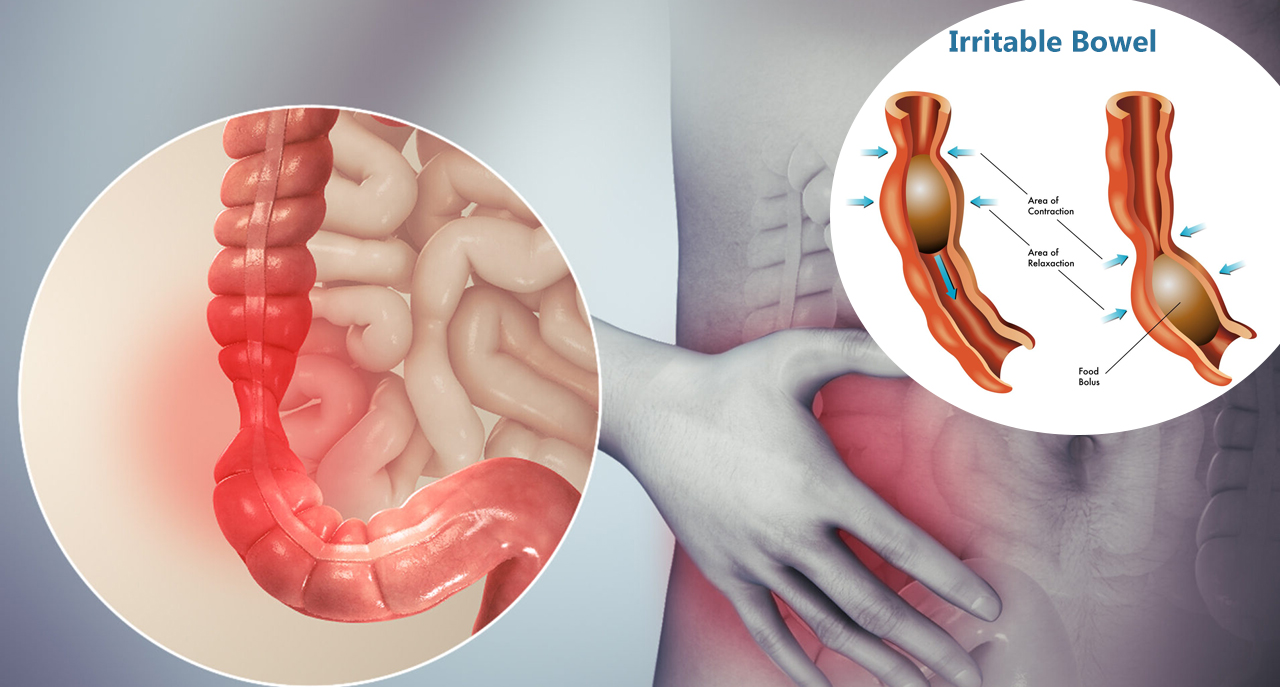 Irritable bowel syndrome related treatment and service by Dr. Gajanan Rodge, best gastroenterologists in Mumbai